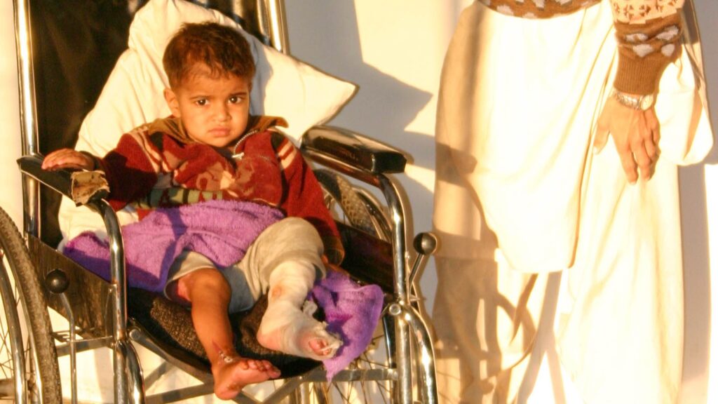 Small child in wheelchair with left leg bandaged next to father